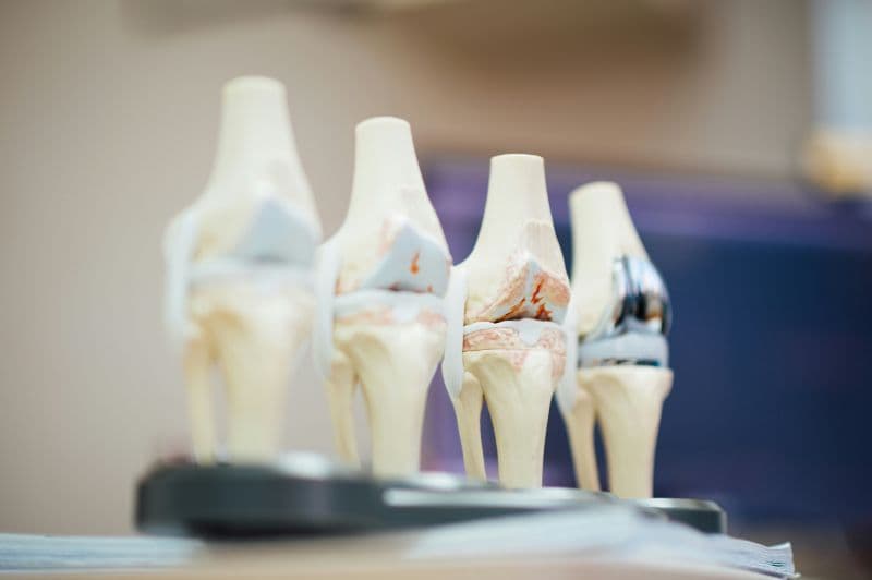 Modelos anatómicos de la rodilla